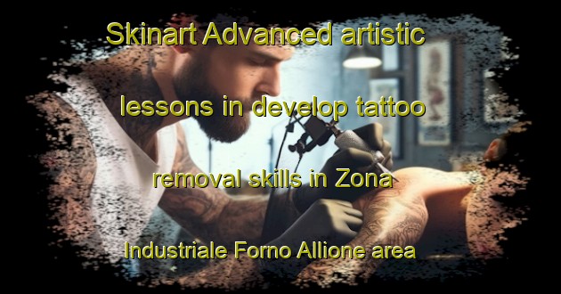 Skinart Advanced artistic lessons in develop tattoo removal skills in Zona Industriale Forno Allione area | RemovalTraining | RemovalClasses | SkinartTraining-Italy