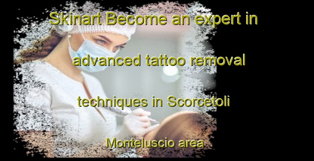 Skinart Become an expert in advanced tattoo removal techniques in Scorcetoli Monteluscio area | RemovalTraining | RemovalClasses | SkinartTraining-Italy