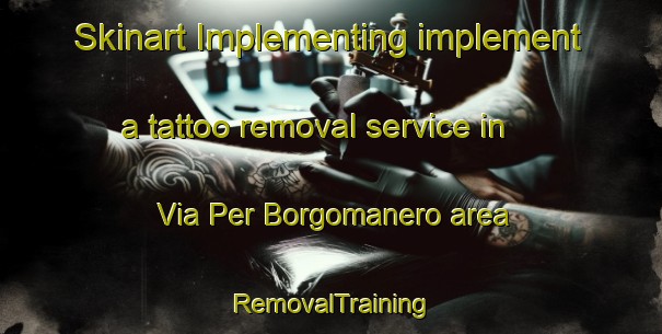 Skinart Implementing implement a tattoo removal service in Via Per Borgomanero area | RemovalTraining | RemovalClasses | SkinartTraining-Italy