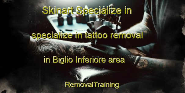 Skinart Specialize in specialize in tattoo removal in Biglio Inferiore area | RemovalTraining | RemovalClasses | SkinartTraining-Italy