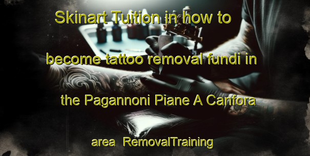 Skinart Tuition in how to become tattoo removal fundi in the Pagannoni Piane A Canfora area | RemovalTraining | RemovalClasses | SkinartTraining-Italy
